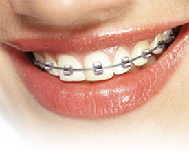 Our Technology - Janisse Orthodontics