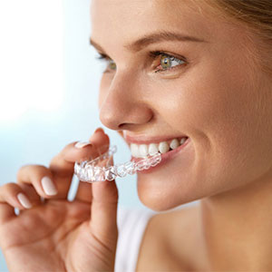 invisalign treatment